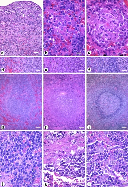 Morphological Changes In The Spleen Of Dogs Naturally I 