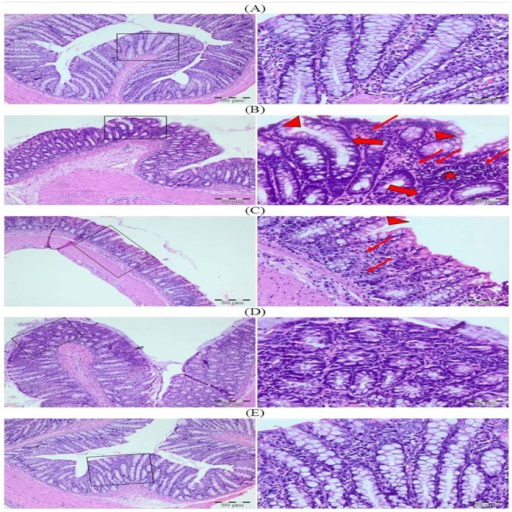 Photomicrographs Depicting Histology Of Rat Colon The H Open I