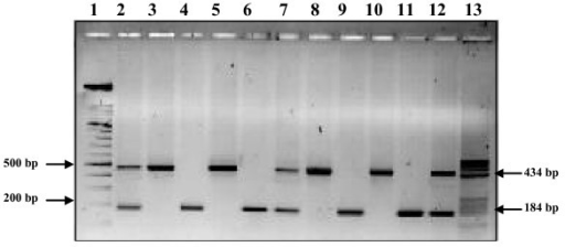 Agarose Gel Electrophoresis Showing Genotypes At In Del Open I