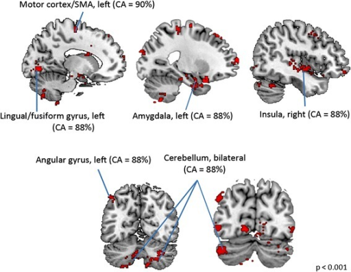 Sex differences in brain and cognition