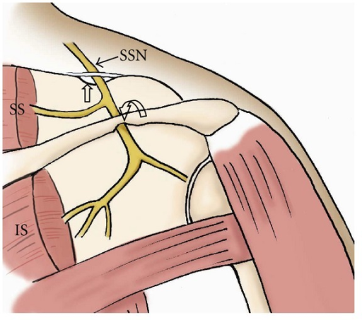 The Drawing Shows Anatomy Of The Suprascapular Nerve Fr Open I