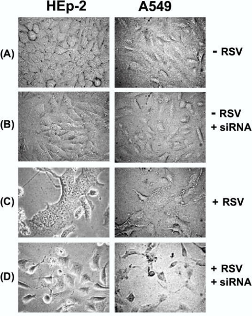 Requirement Of Profilin In Rsv Induced Cell Fusion Pho Open I