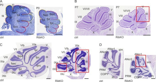 Rictor Deficiency Leads To Foliation Defects In The Cer Open I