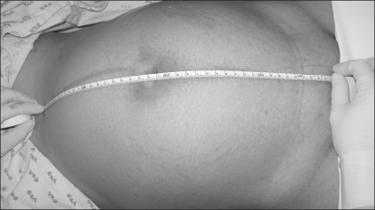 Measurement of the symphysis-fundal height. | Open-i