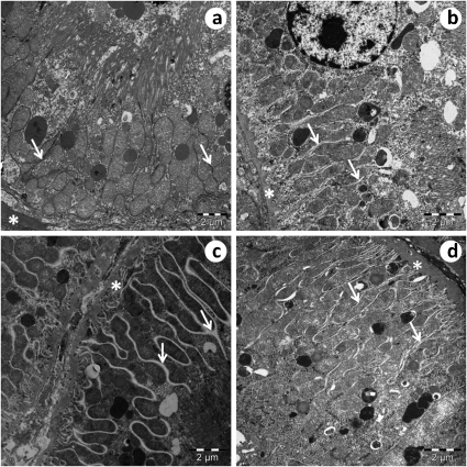 tubule proximal cln