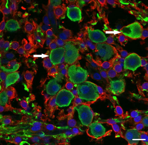 Immunolabeling For Tuj And S In Human Spiral Gangl Open I