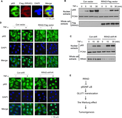 RRAD Inhibits The Nuclear Translocation Of P65 A Immun Open I