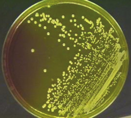 gemoliticheskaya-e-coli-v-sperme