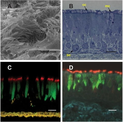 Infection Of Human Ciliated Cells By Piv In Vitro And E 