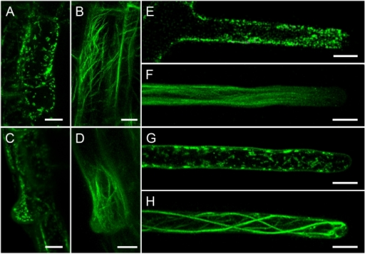 Mitochondrial Distribution And Actin Organization In Ro | Open-i