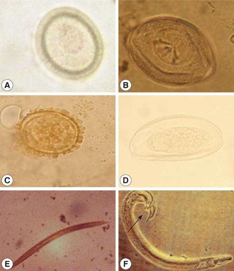 Size, shape, and overall morphologic features of the de | Open-i