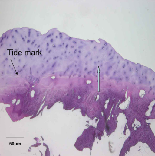 Tide mark evidence for repair tissue. Tidemark evidence | Open-i