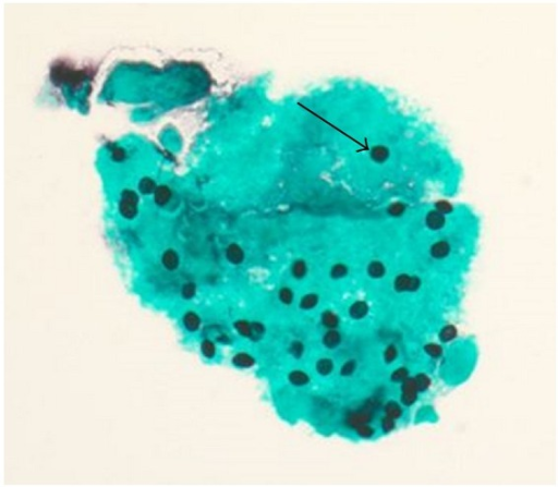 gms stain