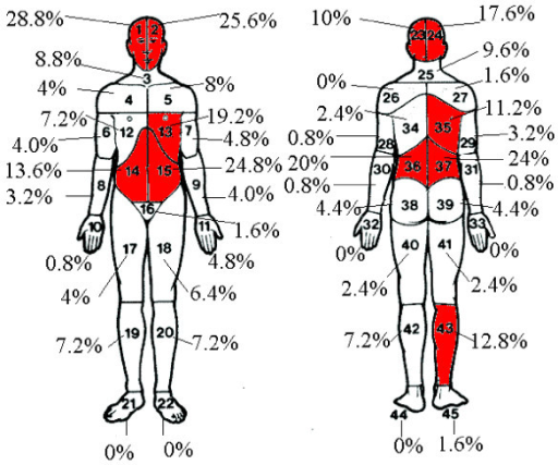 Pain Chart Body Diagram Female