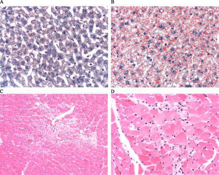 Histopathology of MCAD+/+ and MCAD−/− Mice(A) MCAD+ | Open-i