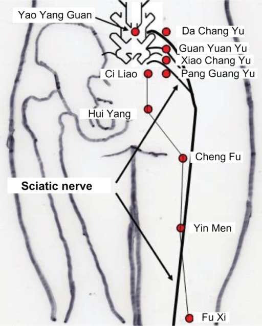 Sciatic Nerve Acupressure Points