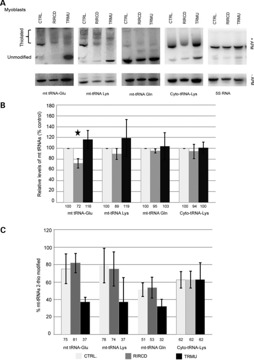 Analyses of 2 thiouridine modification of mt tRNA speci Open i