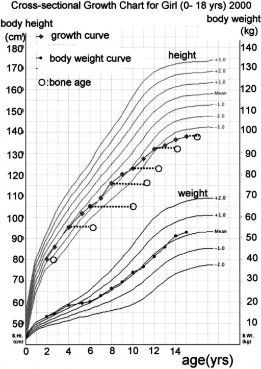 Bone Growth Chart