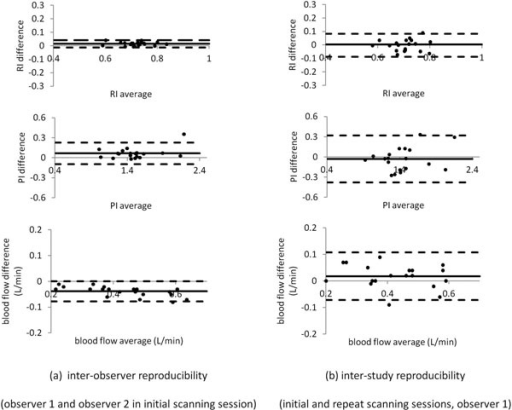 Modified Bland–Altman plots of inter-observer (4 observers; A, B, C and