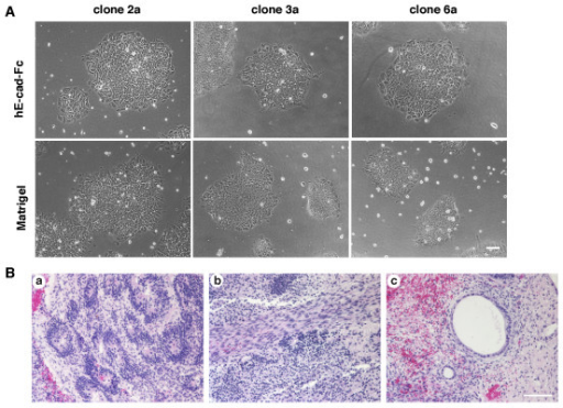 Ips cells human cloning essay
