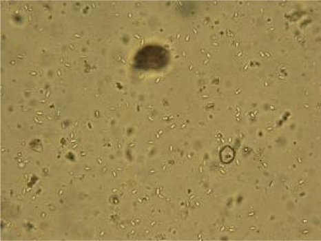 presence of Nosema spore, (wet mount, 400X) in macerate | Open-i