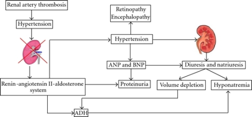 Suggested pathophysiology of the hyponatremic hypertens | Open-i