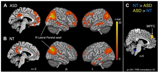 Whole Brain Functional Connectivity Maps With The Right Open I Whole Brain Functional Connectivity Maps With The Right Open I