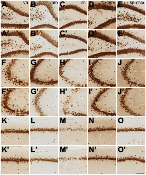 Representative Micrographs From Contralateral A O And Open I