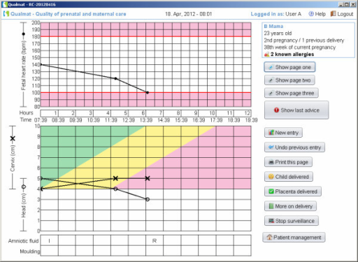 Electronic partograph for visualisation of the progress of delivery ...