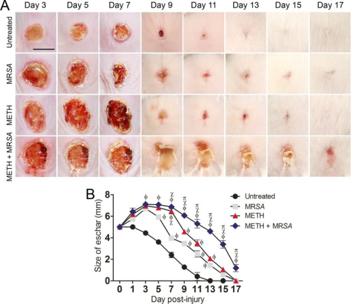 METH Decreases Wound Healing In Mice Infected With MRSA | Open-i