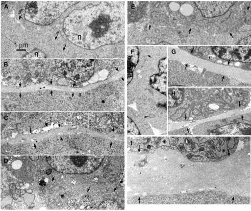 Ultrastructure Of Ebs. Wild-type (r1), γ1-laminin–, 