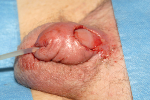 Small penis how to solve this problem