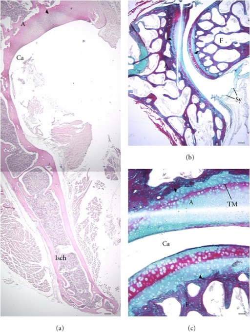 cartilage contact visualization postview colin smith cartilage contact visualization postview colin smith