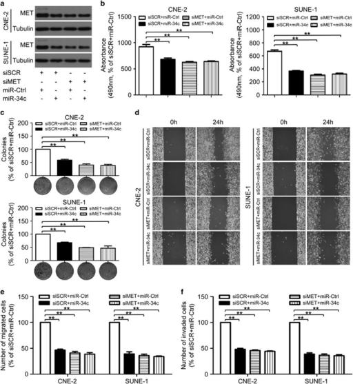 MiR-34c affects NPC cell proliferation, migration and i