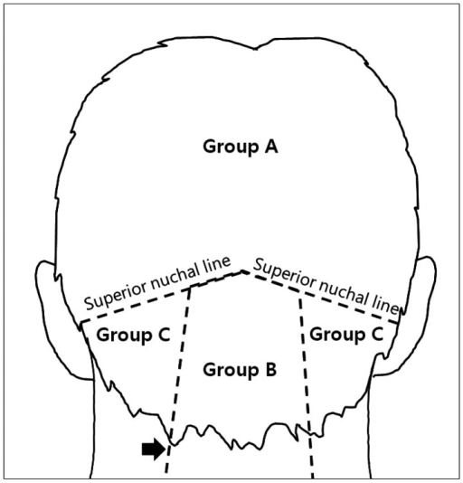 To divide three groups according to anatomical location | Open-i