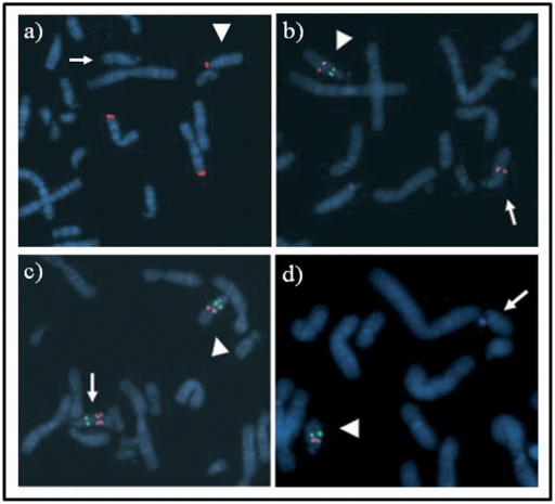 Results of FISH analysis of human male metaphase chromosomes with