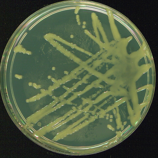 Appearance of Corynebacterium mucifaciens colonies obta | Open-i