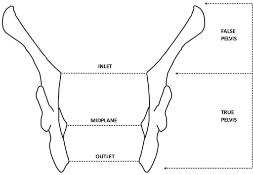 Diagram Of The True And False Pelvis Inlet  Midplane An