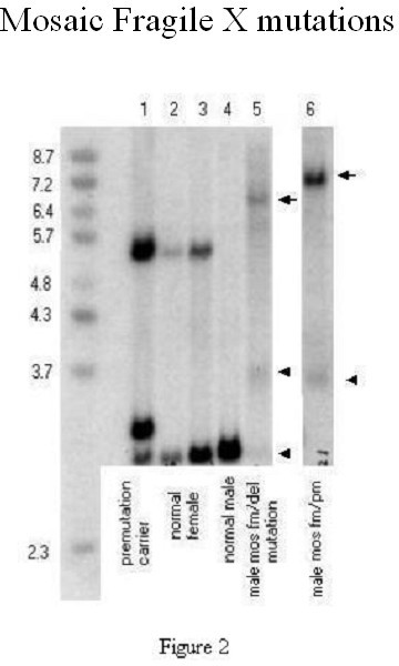 southern blot test results example