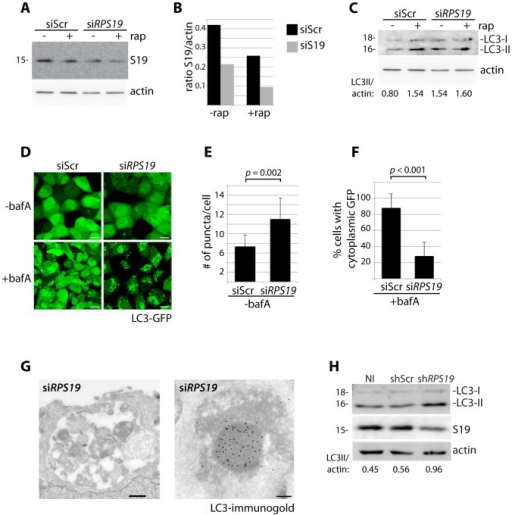 Knock down of RPS19 induces autophagy.(A) Western blot | Open-i