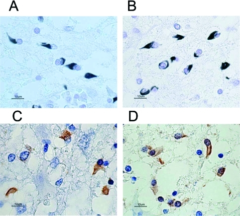 Gallyas–Braak staining shows cytoplasmic inclusions i | Open-i