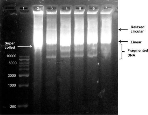 Agarose gel electrophoresis of plasmid pZPY112 treated | Open-i