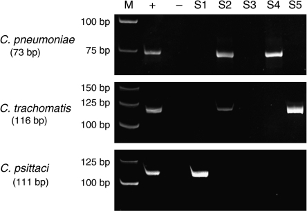 chlamydia psittaci pcr - chlamydia psittaci diagnosis