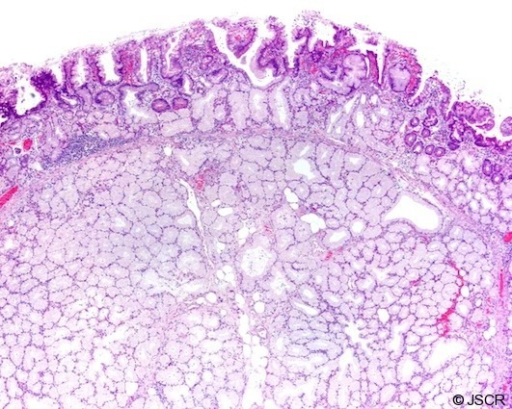 Brunner Gland Histology