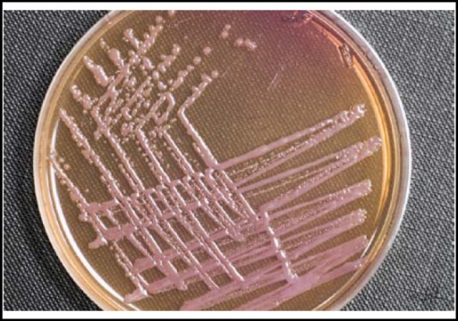 non-lactose-fermenting-bacteria-colonies-on-macconkey-a-open-i