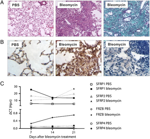 Wnt And Sfrp Dynamics In Bleomycin Induced Lung Fibrosi Open I