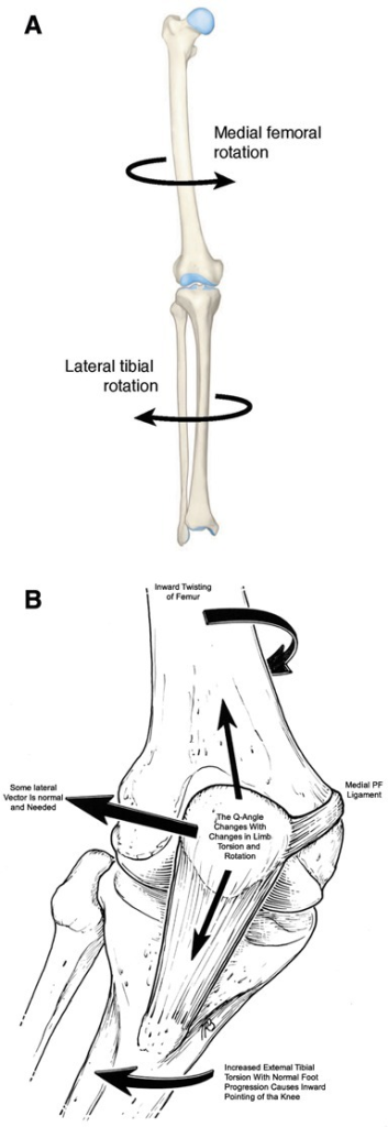 Femoral Torsion Angle