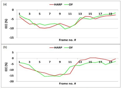 Circumferential Strain Ecc Measurements In Human Subj Open I