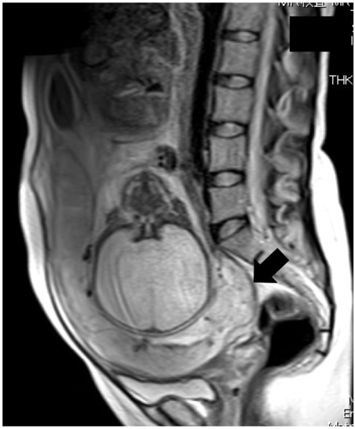 MRI image of the abdomen.Note: Axial T2-weighted MRI im | Open-i