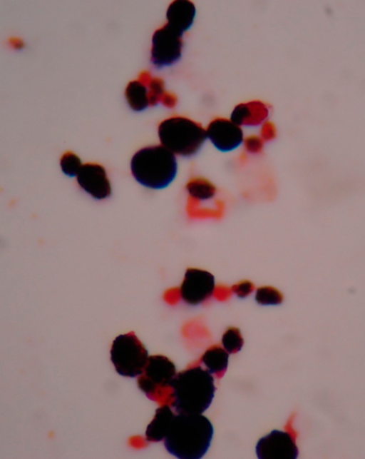 Gram Stain Of Blood Culture Reveals Spherical Gram Posi Open I 